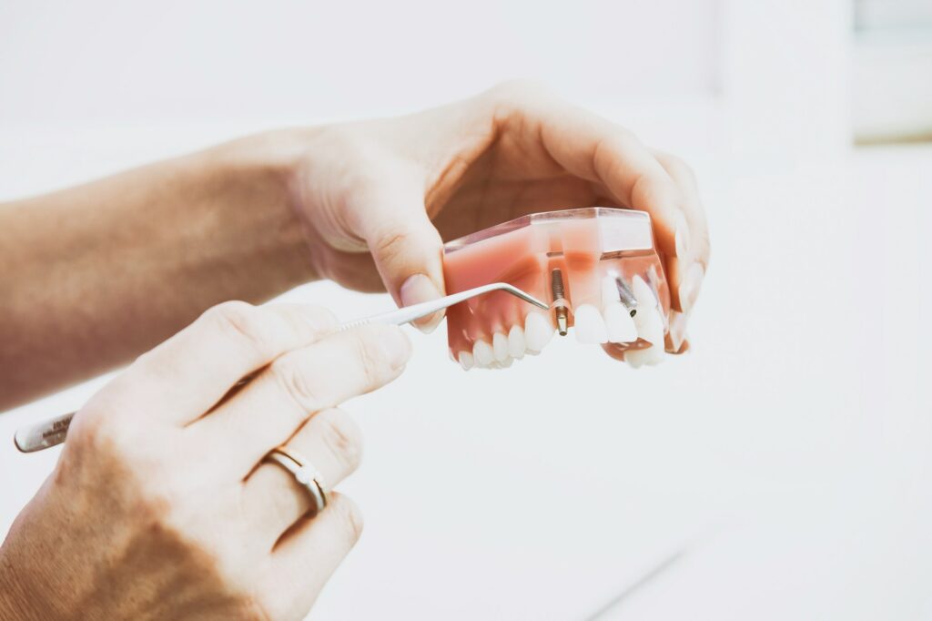 Dental Crowns
